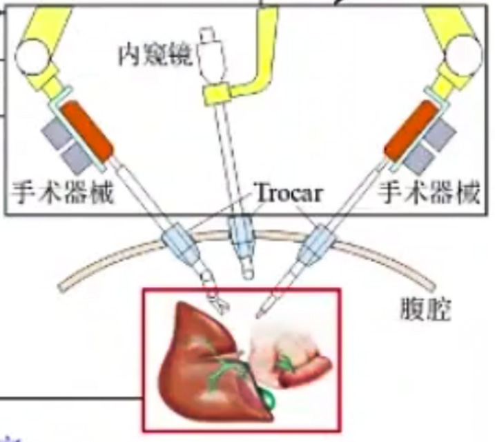 腹腔镜手术机器人结构设计原理—AIP艾普